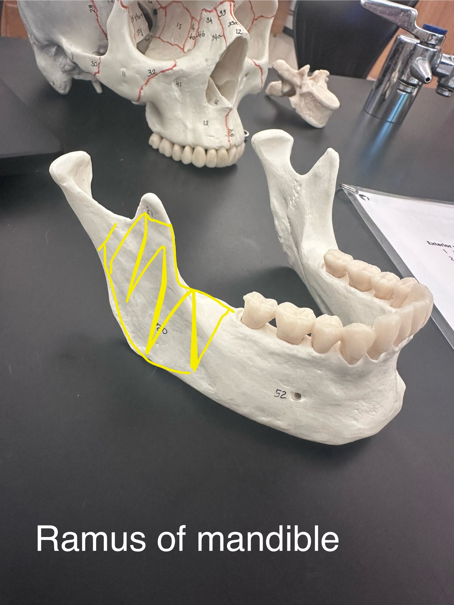 <p>Ramus of mandible (rami for plural)</p>