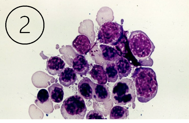 <p>What do these cells indicate?</p>
