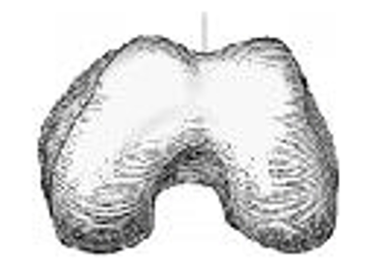 <p>patella surface</p>