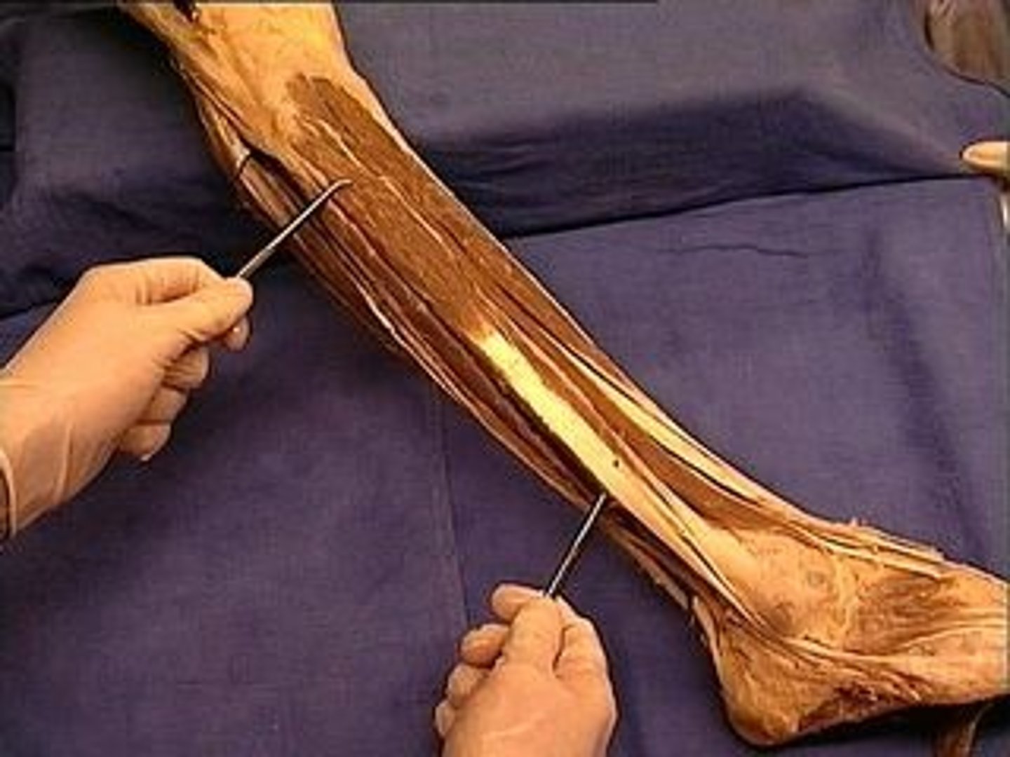 <p>ISOLATED FUNCTION: concentrically plantarflexes and everts the foot INTEGRATED FUNCTION: decelerates ankle dorsiflexion, isometrically stabilizes the foot and ankle complex</p>