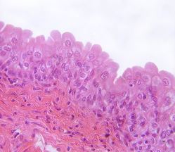 <p>What epithelial tissue is this?</p>