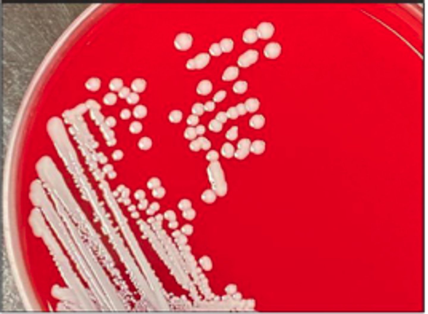 <p>BA plate culture from a case of acute exudative dermatitis in a recently weaned pig. The plates</p><p>were incubated at 37oC for 24 hrs. There was no growth on MAC. This organism is catalase-positive.</p><p>Is the organism hemolytic or not? _____</p><p>Colony colour: ________</p>
