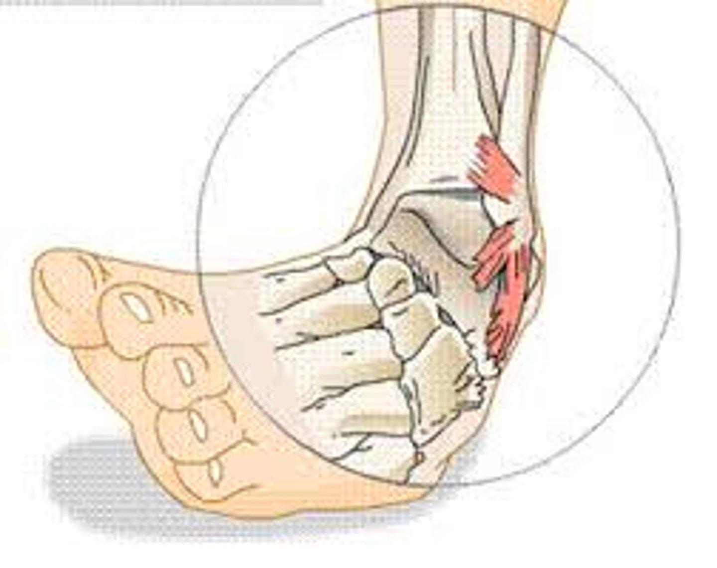 <p>to sprain</p>