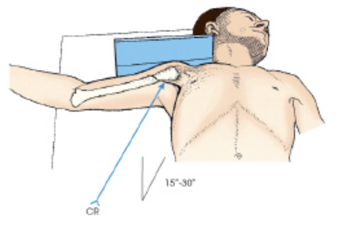 <p>The projection of the shoulder demonstrated in this figure is the:</p>