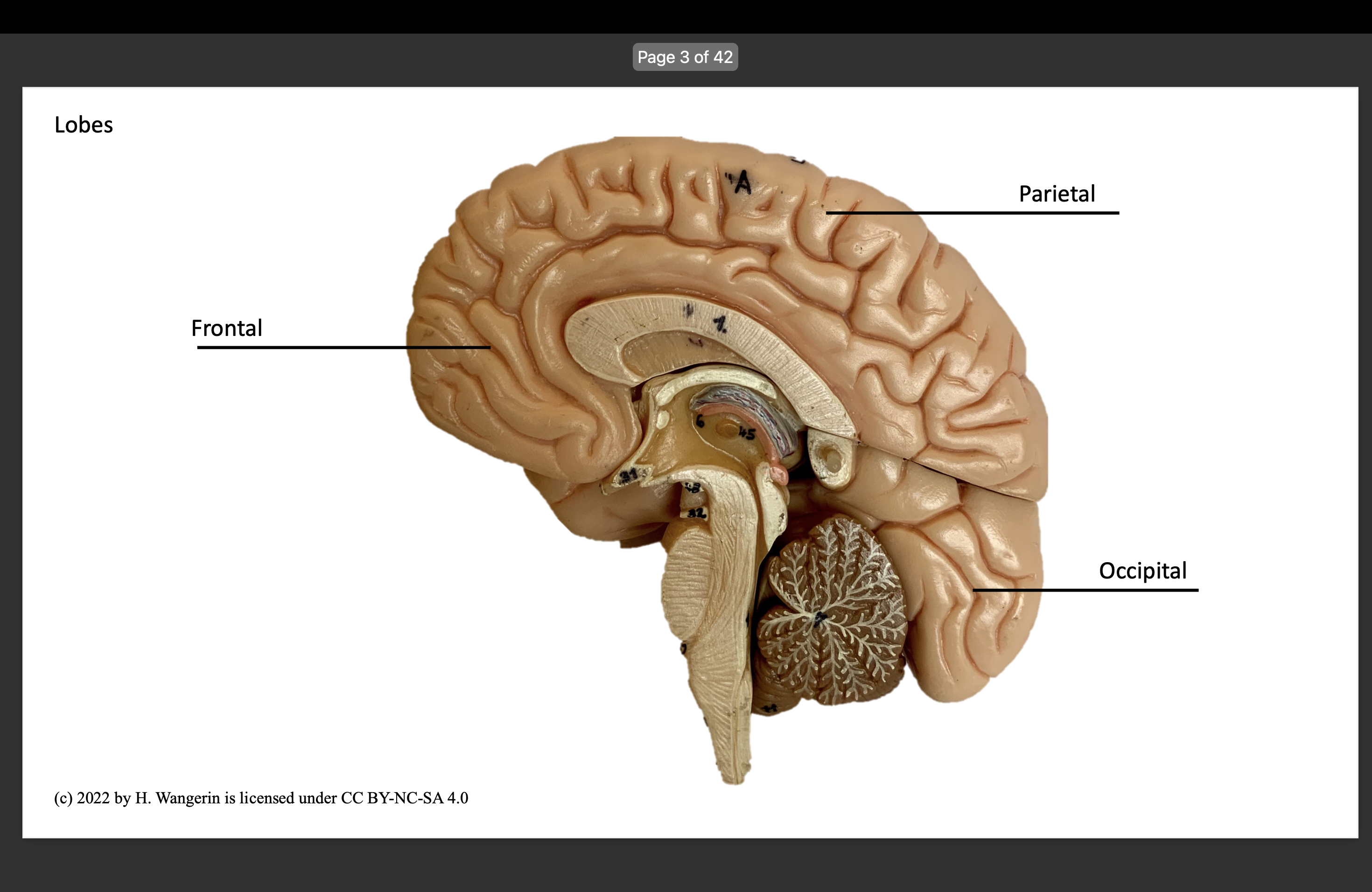 <p>Parietal </p>