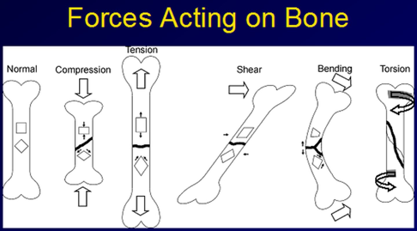 <ol><li><p>axial compression</p></li><li><p>tension</p></li></ol><ol start="3"><li><p><span><span>Bending (when weight bearing, when the leg is placed at an angle to ground or as a result of asymmetrical muscle contraction)</span></span></p></li><li><p><span><span>Torsion (when body changes direction with leg planted on ground)</span></span></p></li></ol><p></p>