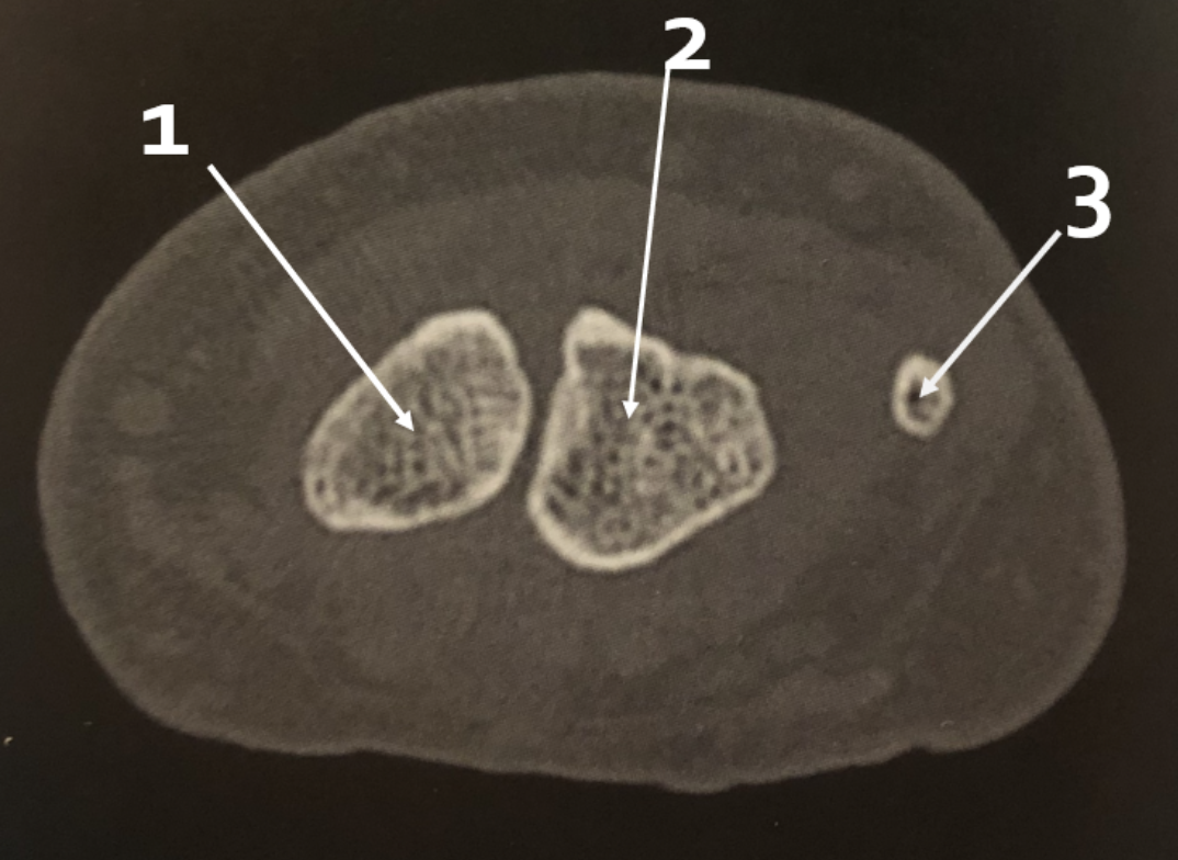 <p>1</p>