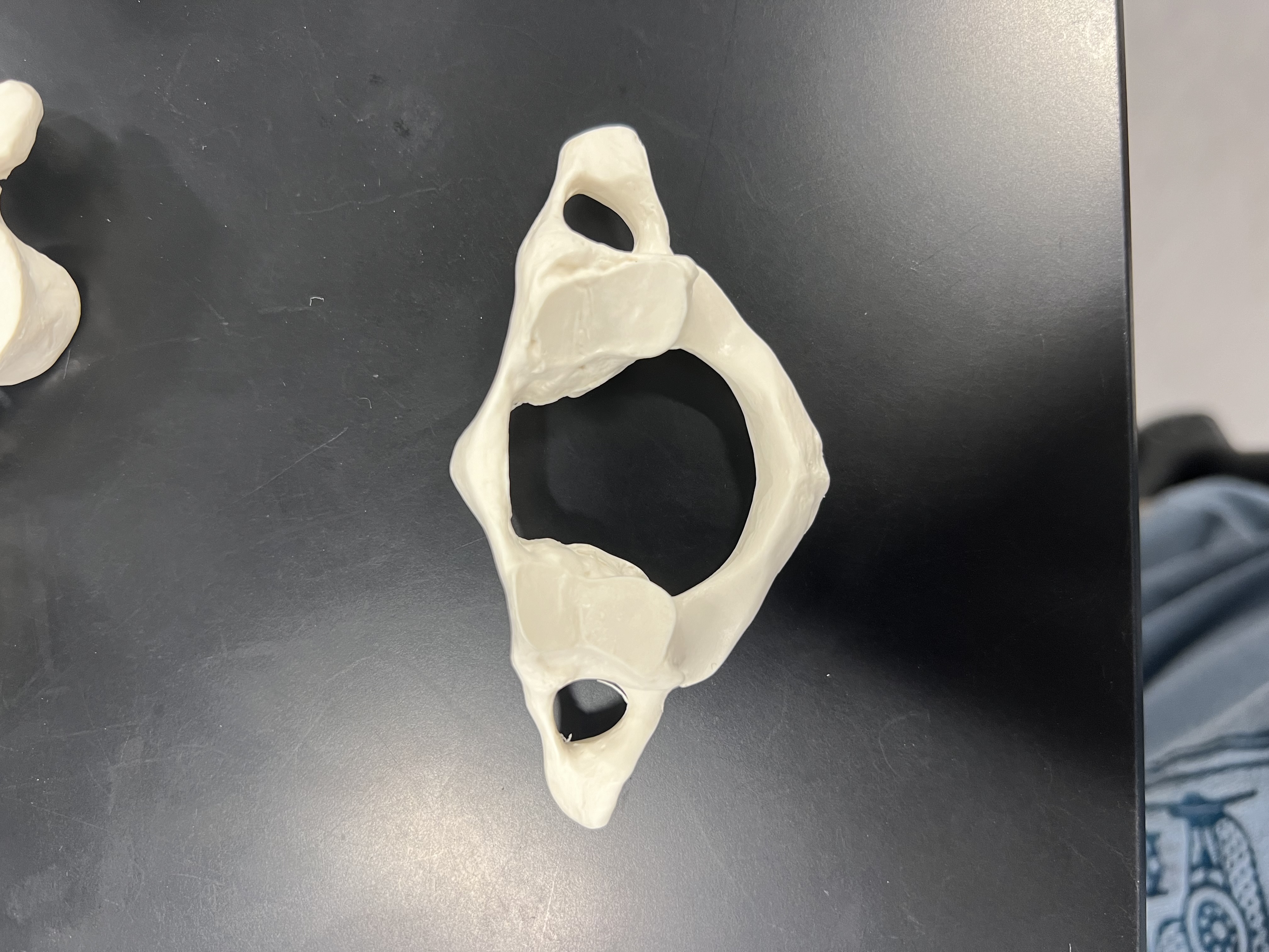 <p>what vertebrae is this</p>