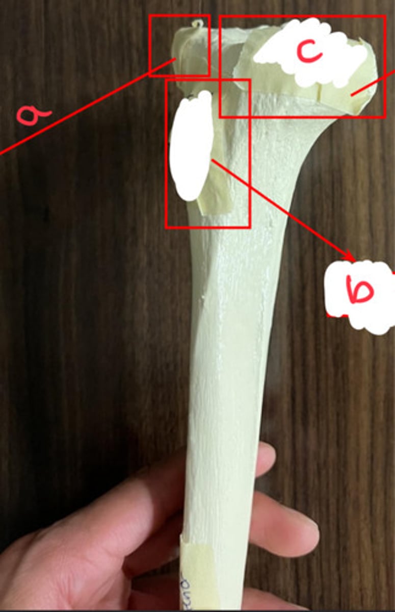 <p>what structure is labeled by b?</p>