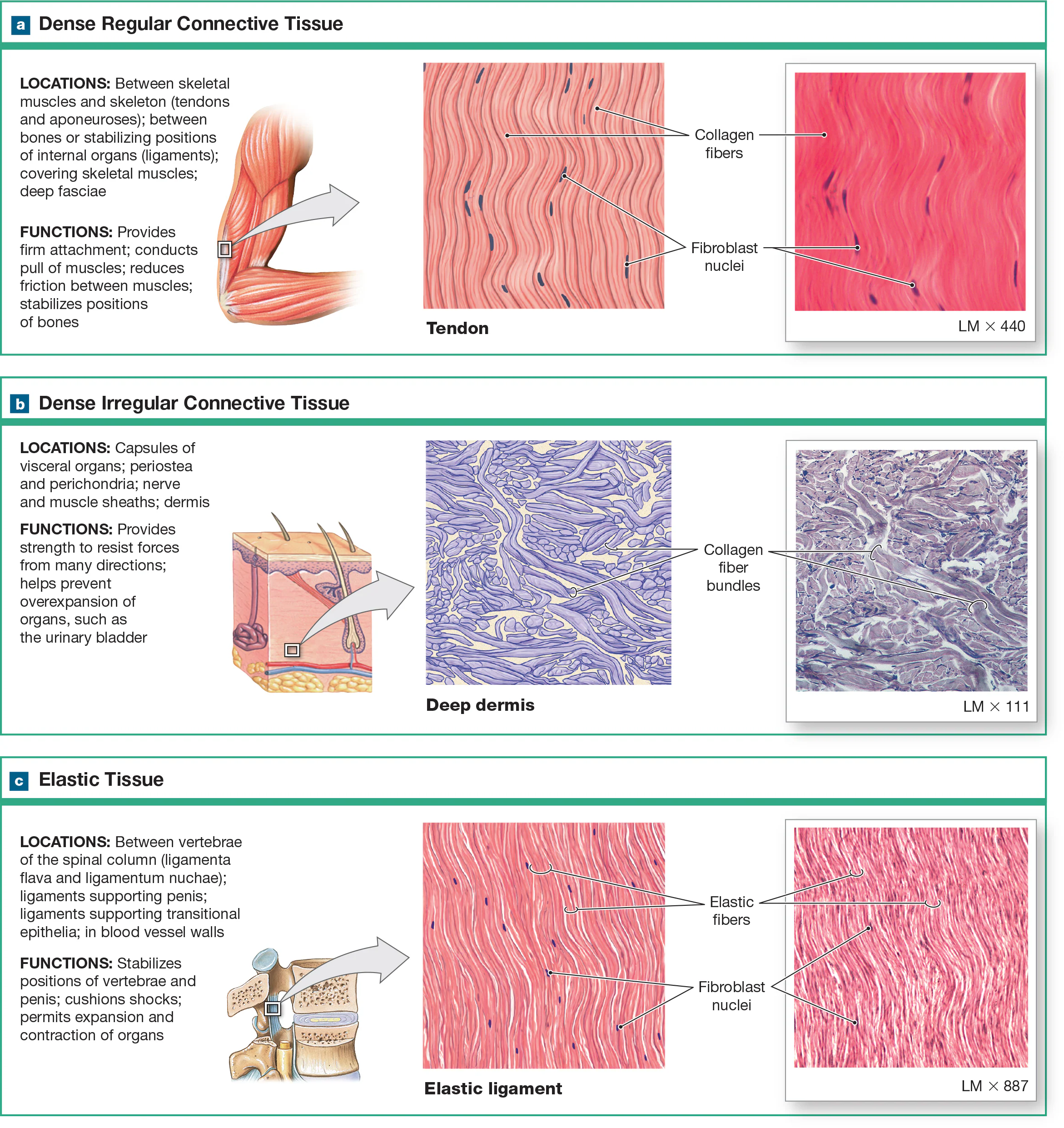 <p>Dense irregular CT</p>