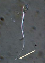 <p>Identify the sperm morphology.</p>
