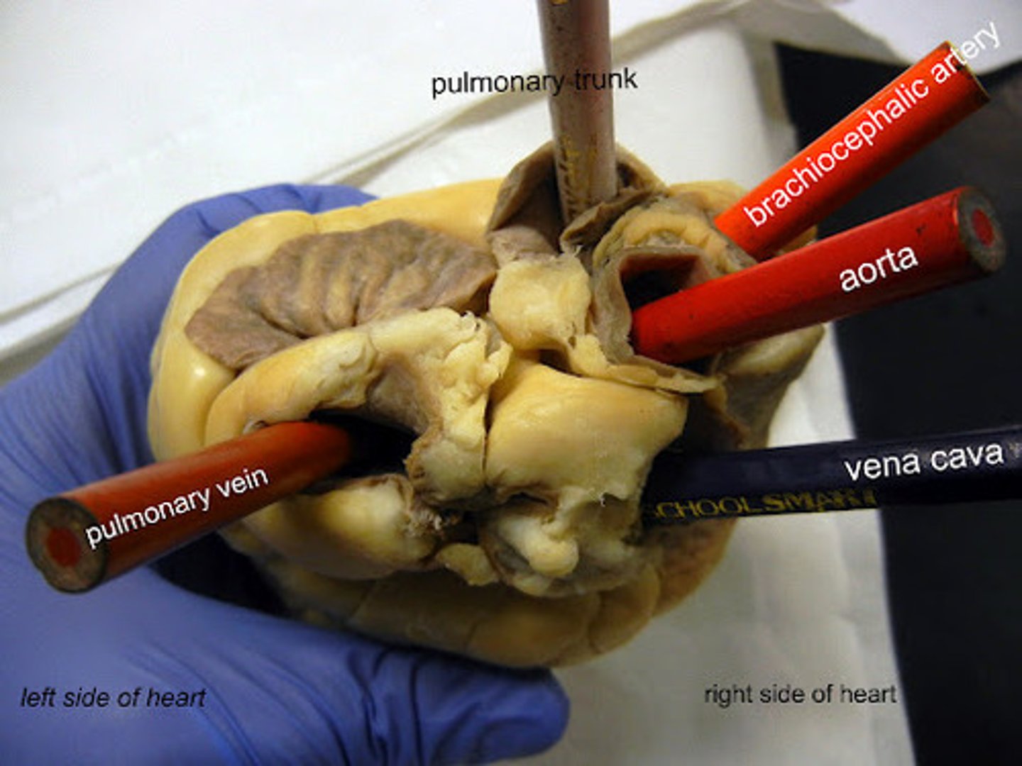 <p>where blood gets sent out through out the body</p>