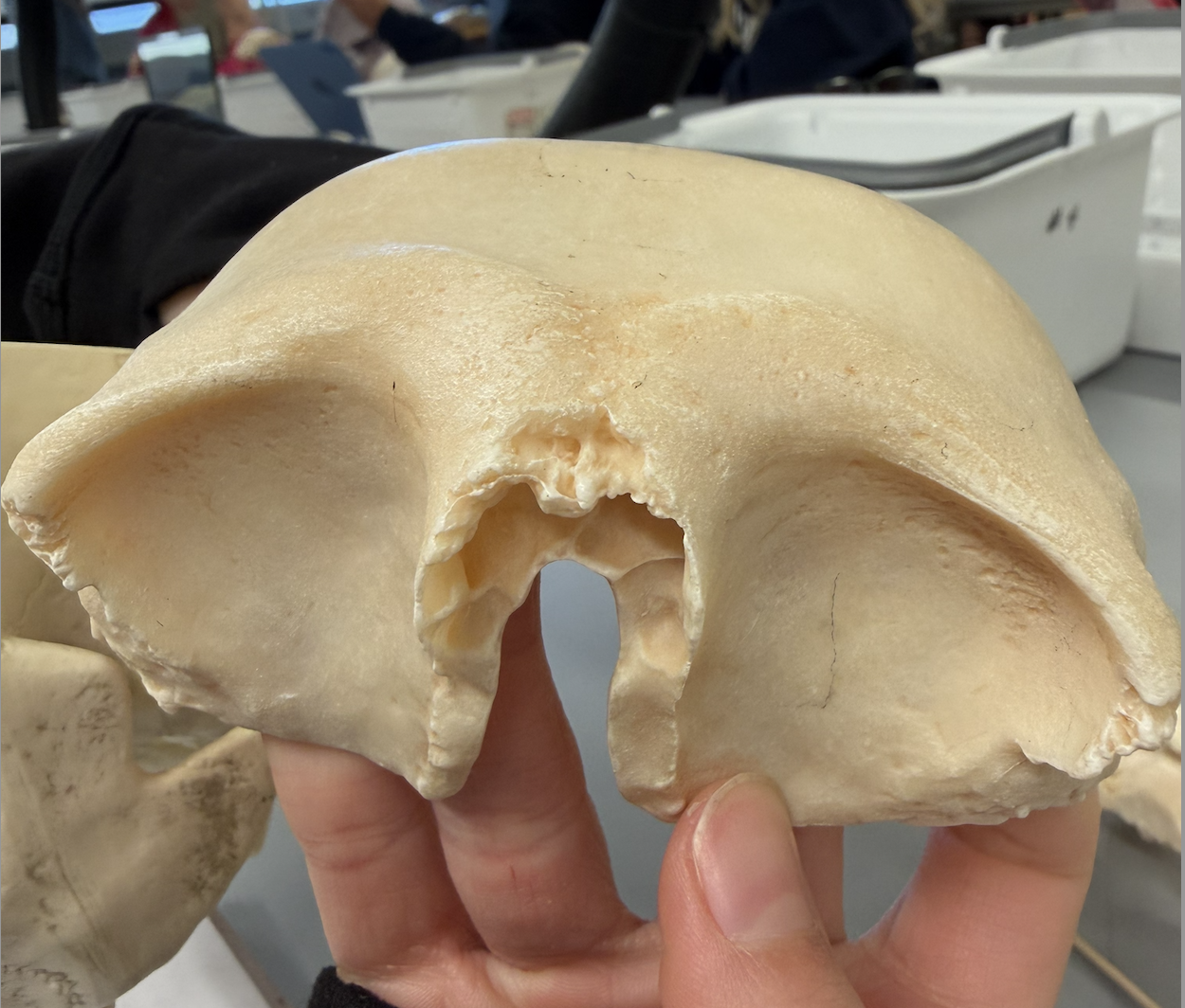 <p>anterior cranium; articulates posteriorly with parietal bones @ coronal suture; contains sinuses</p>
