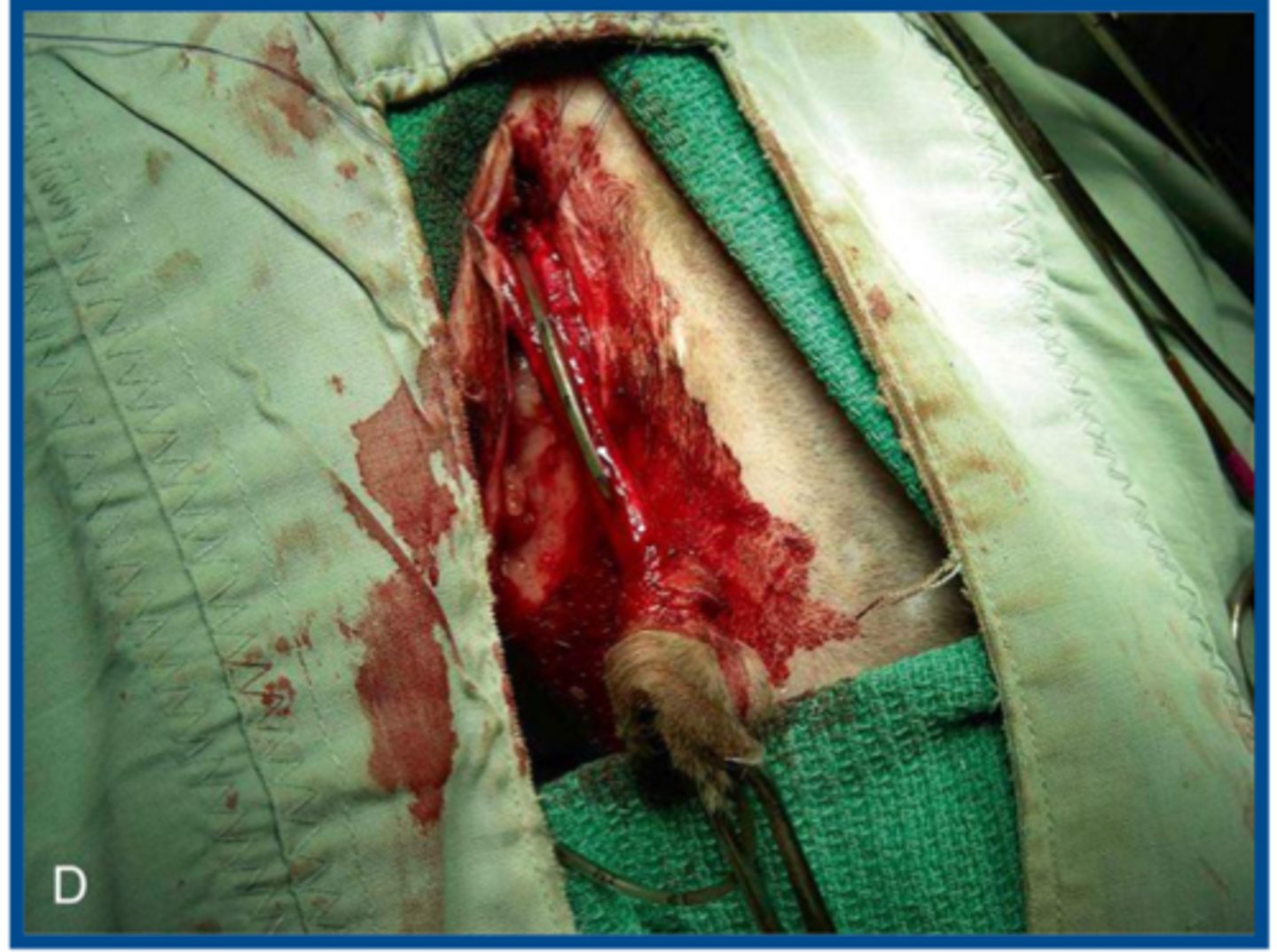 <p>failure to perform which step in feline perineal urethrostomy can result in a urethral opening of insufficient diameter and predispose the patient to urinary tract blockage...defeats the whole point of the sx.</p>