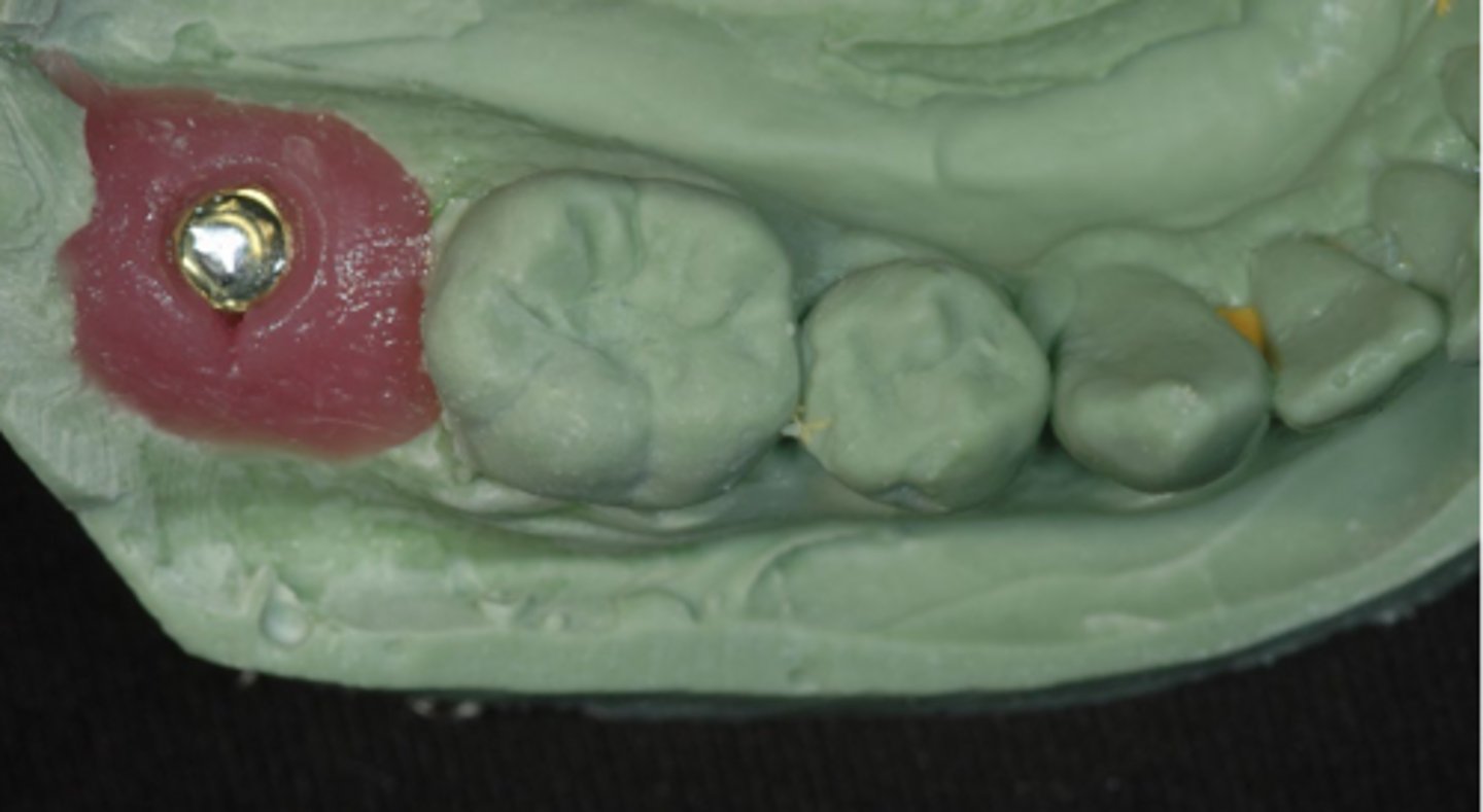 <p>What type of stone was this from?</p>