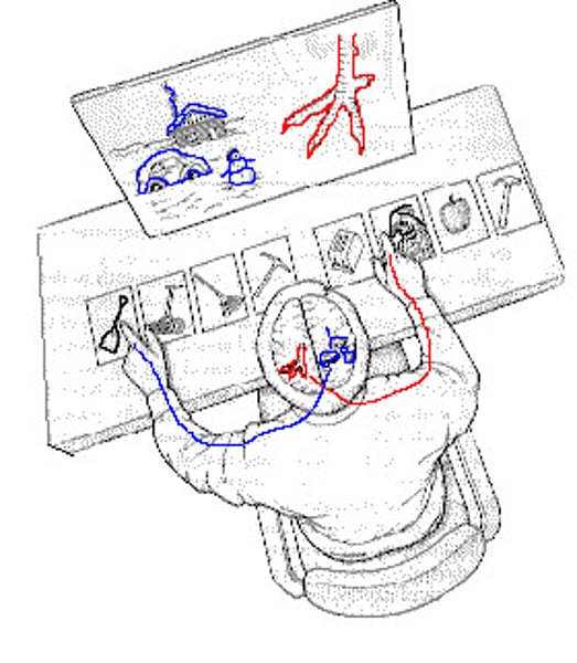 <p>A conditioning resulting from surgery that isolates the brain's two hemispheres by cutting the fibers connecting them.</p>