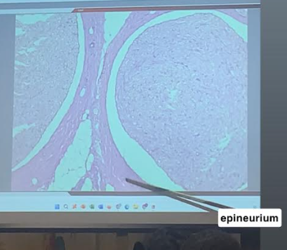 <p>Epineurium</p>