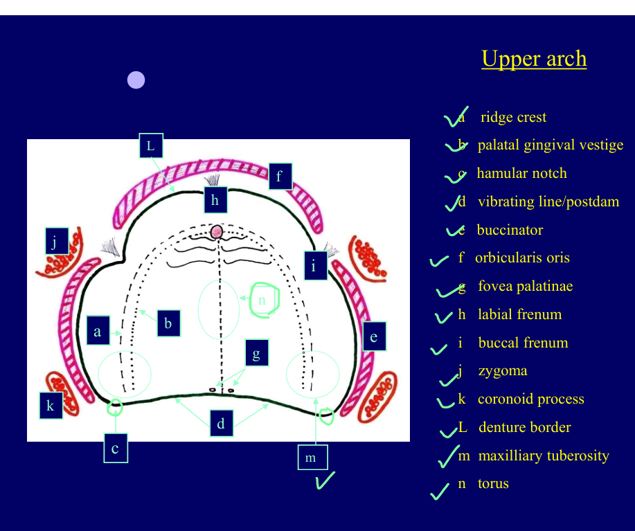 <p>Pink - the muscles that influence the borders of the denture</p><p>Red - bone components</p><p></p>