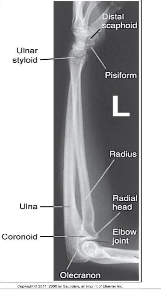 <p><span style="line-height: normal;"><span>• </span></span>Carpals and distal humerus included</p><p class="p1"><span style="line-height: normal;"><span>• </span></span>Elbow flexed 90°</p><p class="p1"><span style="line-height: normal;"><span>• </span></span>Head of ulna superimposed over radius</p><p class="p1"><span style="line-height: normal;"><span>• </span></span>Radial head superimposed by coronoid</p><p class="p1"><span style="line-height: normal;"><span>• </span></span>Radial tuberosity is superimposed over medial radial shaft</p><p class="p1"><span style="line-height: normal;"><span>• </span></span>Humeral epicondyles are superimposed</p>