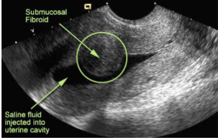 <p>What is this and what type of scan </p>