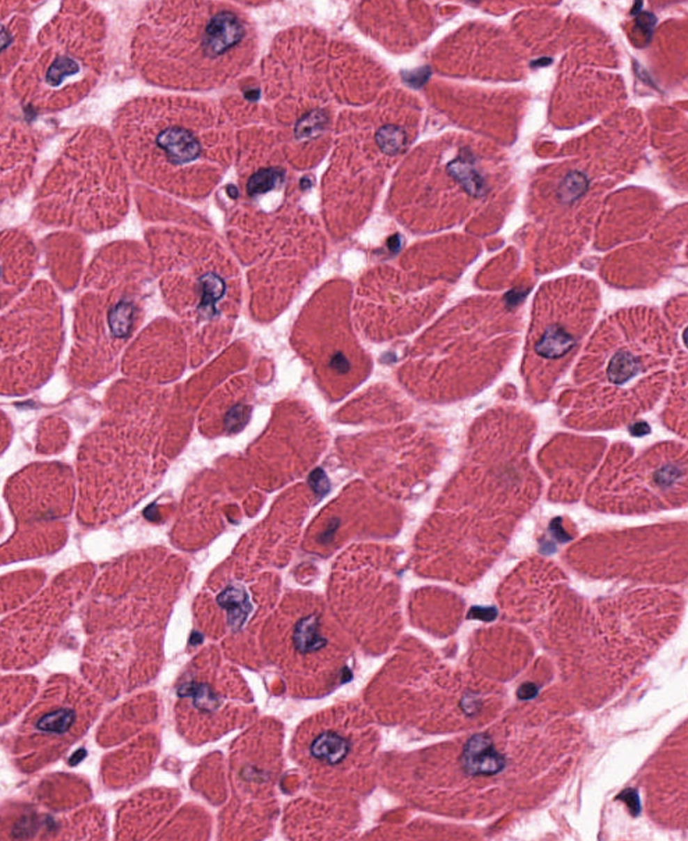 <p>Muscle tissue that has short branching fibers, have a single, centrally located nucleus, show the same striations as skeletal muscle, and are under involuntary control. It is responsible for keeping the heart pumping blood around the body.</p>
