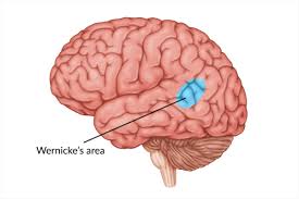 <p>Wernicke’s Area (in left temporal lobe)</p>