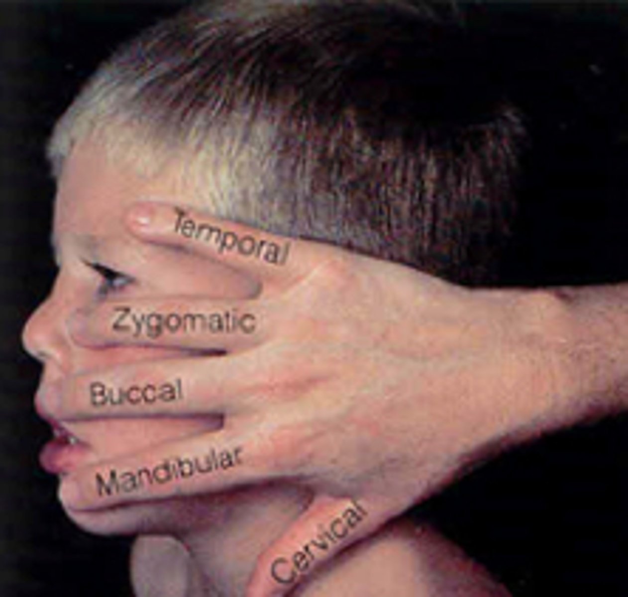 <p>branch division occurs deep to the R/L parotid gland</p><p>Temporal</p><p>Zygomatic</p><p>Buccal</p><p>Mandibular</p><p>Cervical</p><p>"those zany biologists memorize cranial nerves"</p>