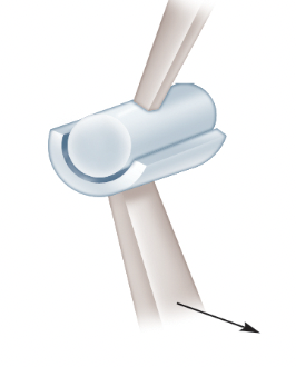 What type of synovial joint is listed in the picture?
