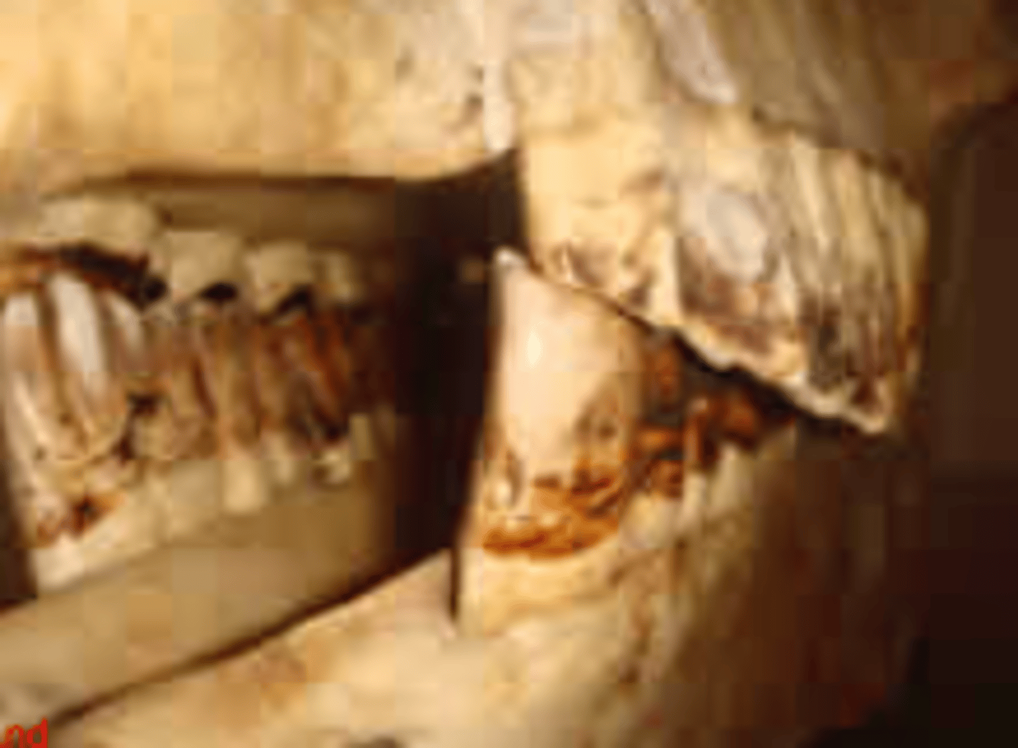 <p>What is the pathology?</p>