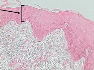 <p>What type of tissue is this? </p>