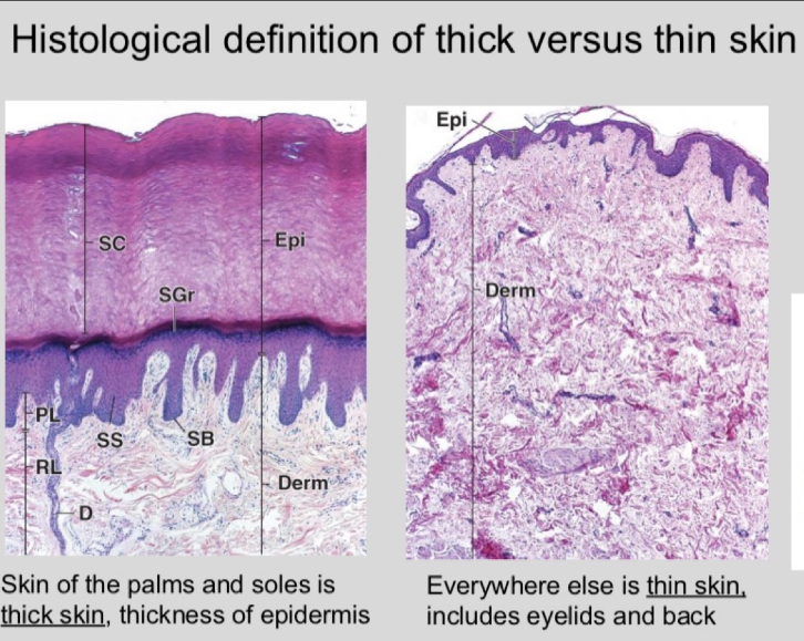 <p>thick versus thin is based on the epidermis</p><p>thick is found on the palms and soles; thin is everywhere else</p><p>thick skin has stratum lucidum</p>