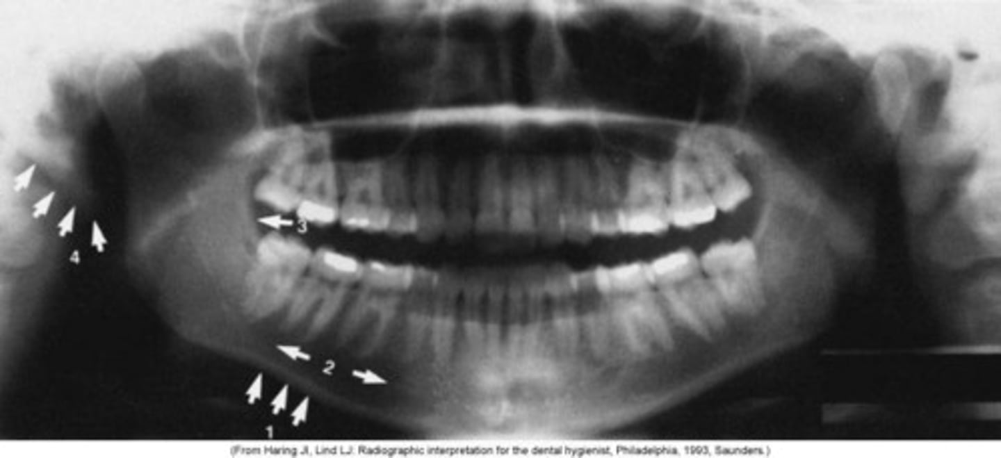 <p>number 2</p>