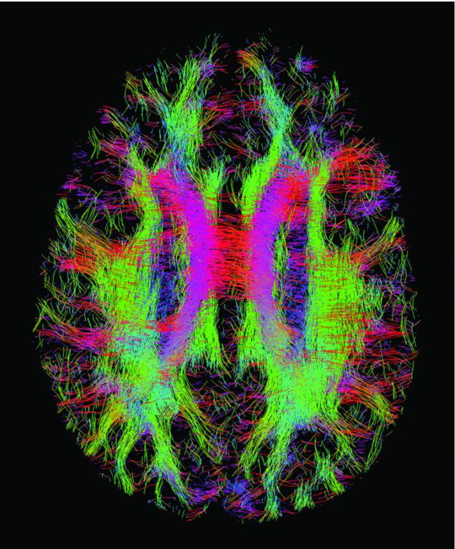 <p><strong>CONNECTOME</strong></p>