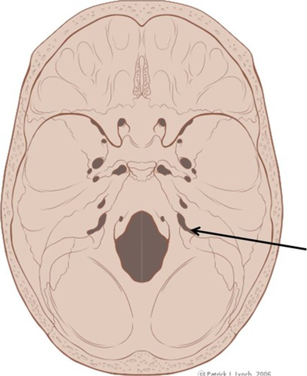 <p>Inferior to the internal auditory meatus, Jellybean shaped, Temporal border with occipital</p>