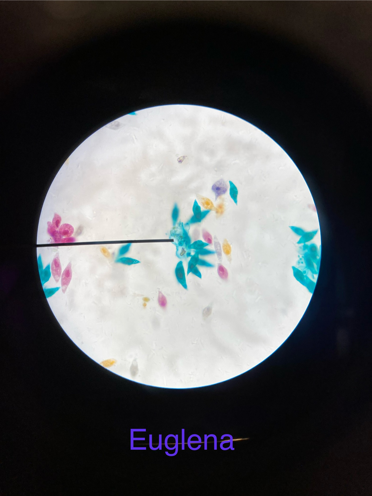 <p>Euglena</p><p></p><ul><li><p>Moves with 1 flagellum</p></li><li><p>Can photosynthesize or ingest food</p></li><li><p>Plant- and animal-like</p></li></ul><p></p>