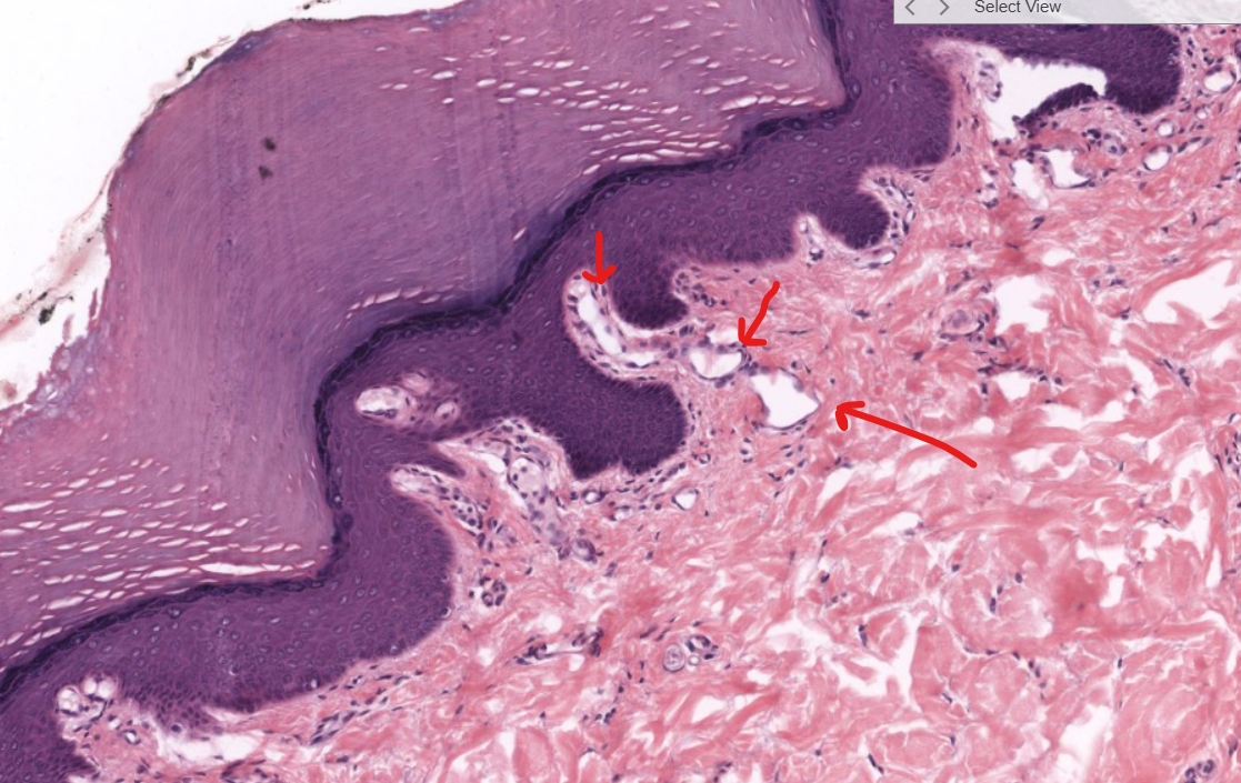 <p>(structure)</p>