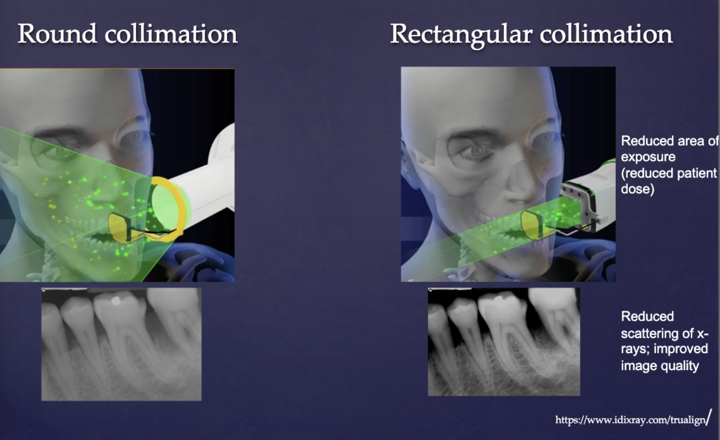 <p>limits size of the x-ray beam to the size of intraoral sensor reducing unnecessary exposure</p>