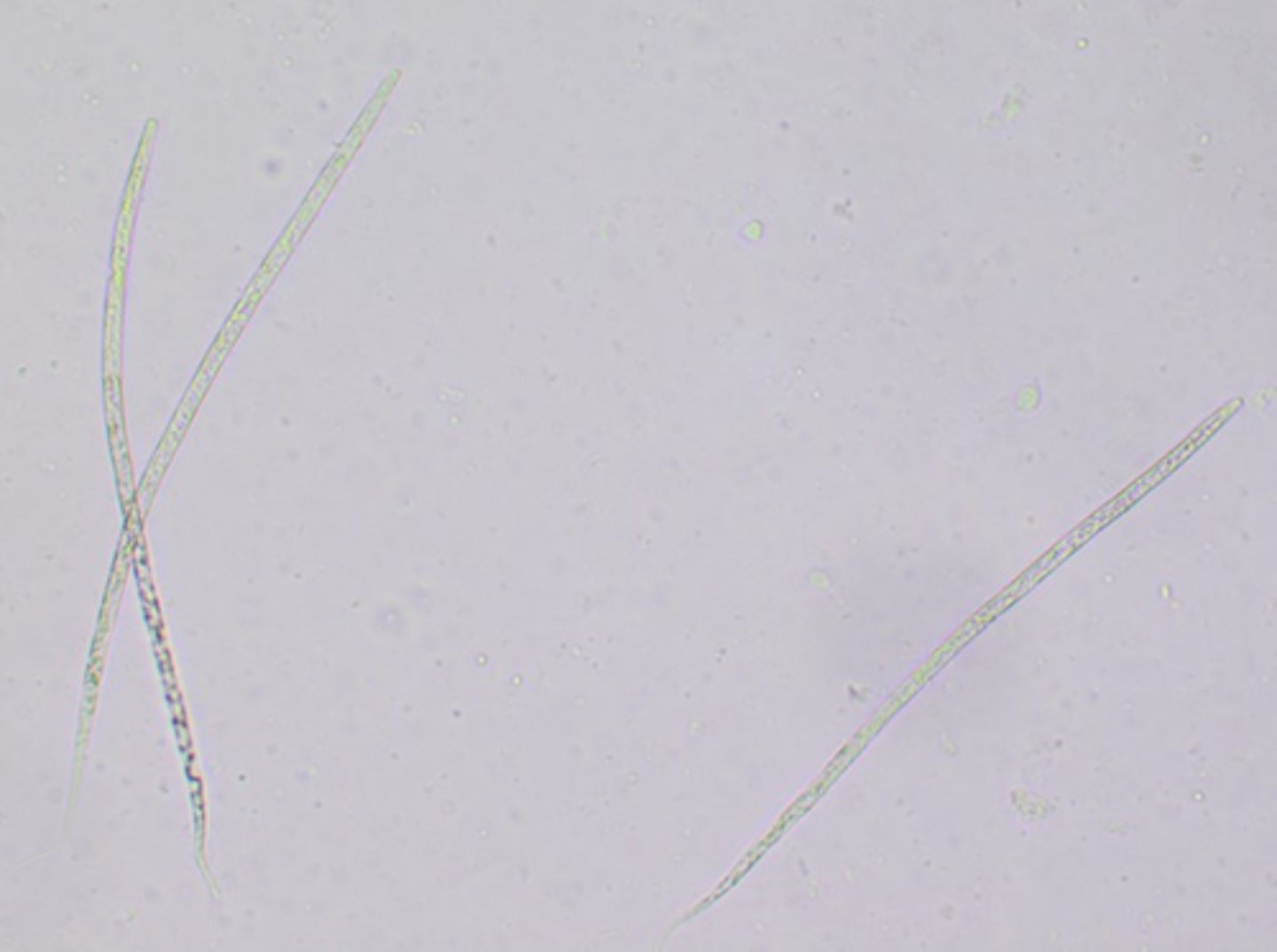 <p>These microfilariae seen on a blood examination average > 300um. What parasite is producing them?</p>