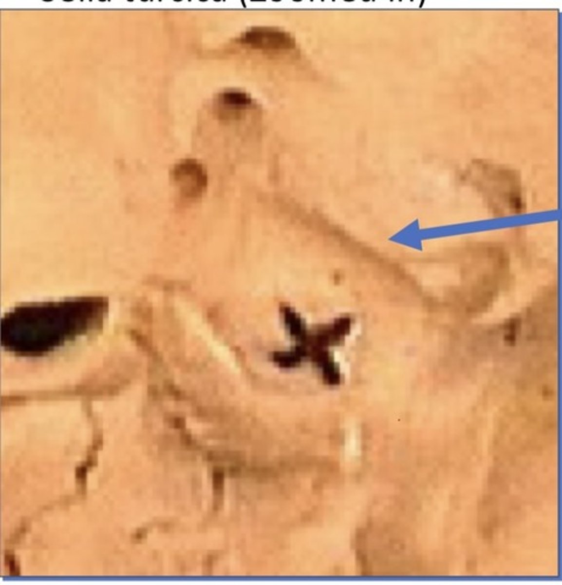 <p>2. Anterior to sella turcica</p>