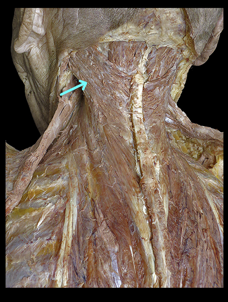 <p>Structure</p>