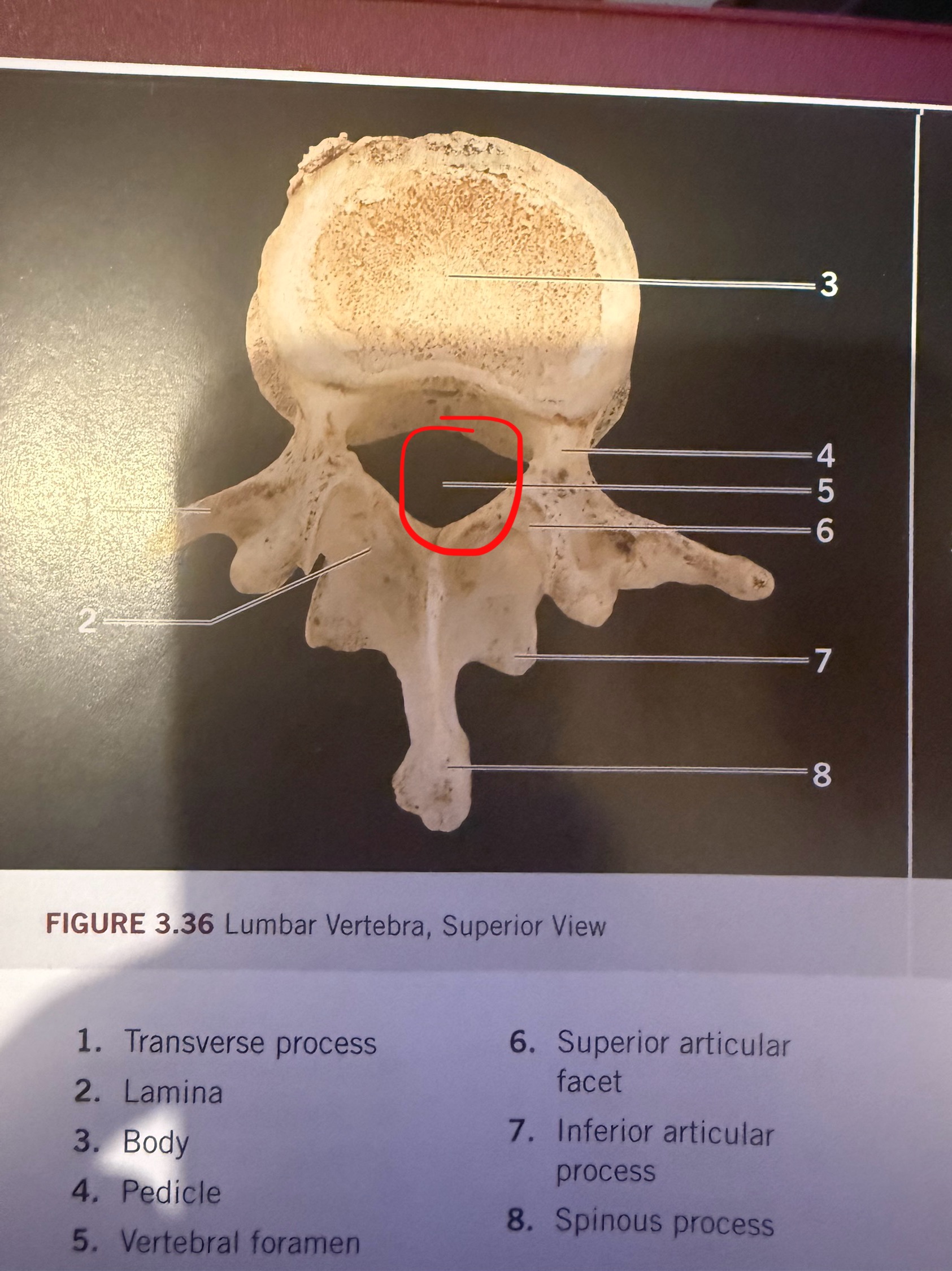 term image