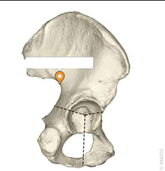 <p>the notch posterior to the posterior inferior iliac spine of the ilium </p>