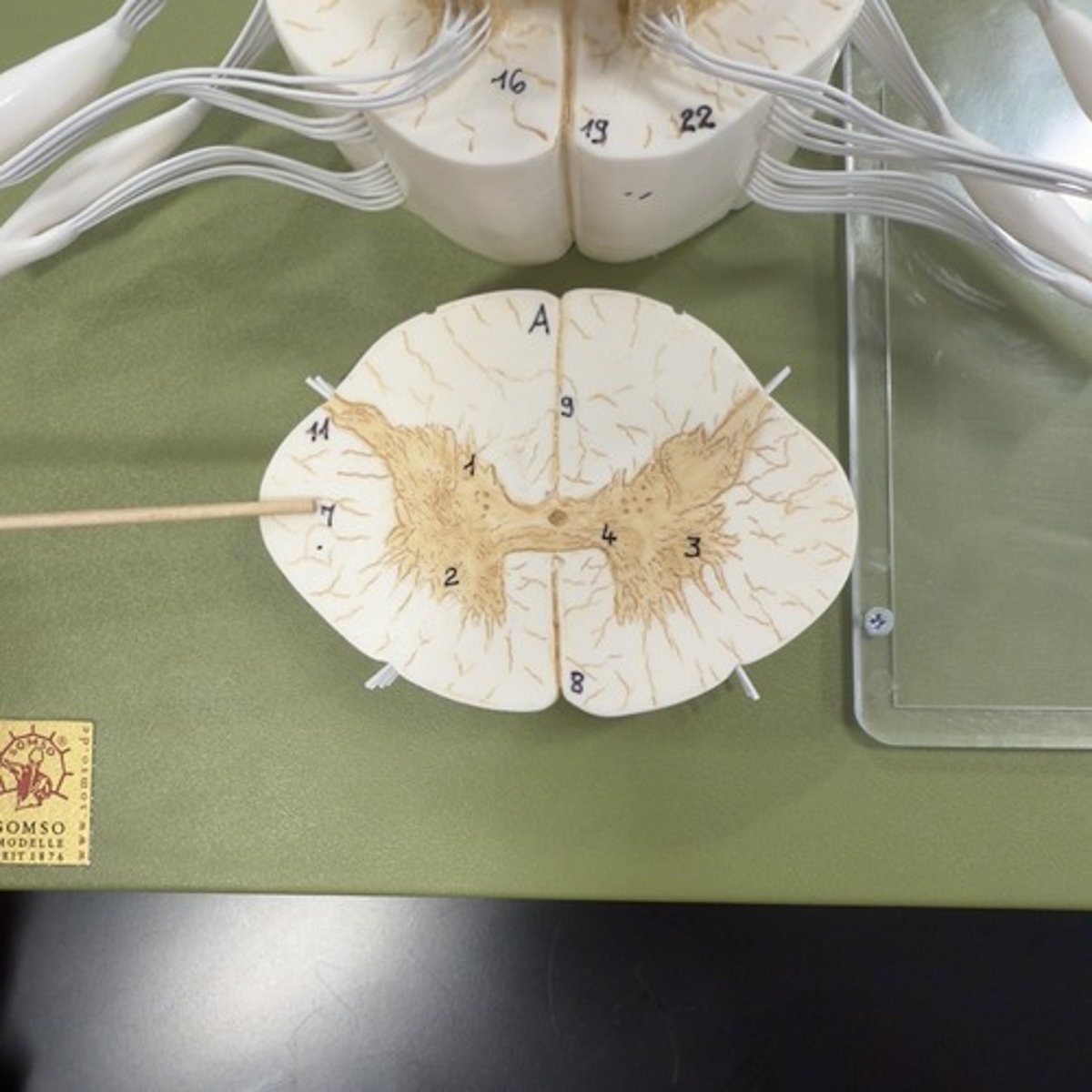 <p>Identify the structure.</p>