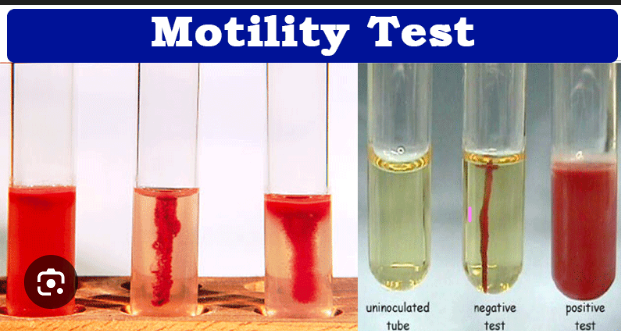 <p>To see if the bacteria can move using flagella.</p>