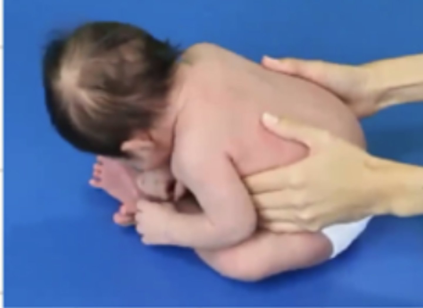 <p>Head lag with no UE, abdominal, or LE activity</p><p>Normally the infant will respond with increased awareness and express this through facial expressions</p><p>Strong grasp reflex promotes strong grasp/grip</p><p>Supported sitting promotes brief moments of attempts to lift head/neck but quickly falls forward</p>