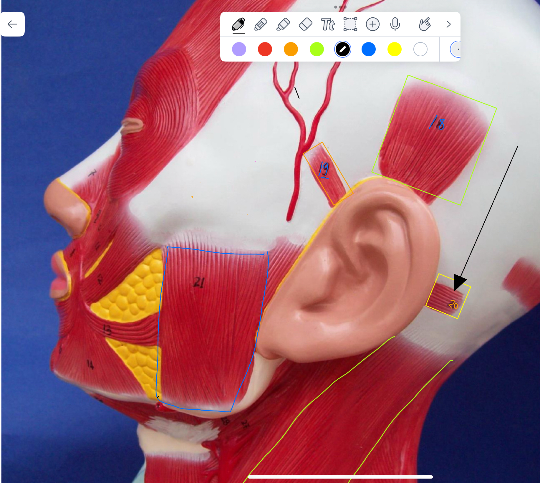 <p>What type of muscle is this ( altay model )</p>