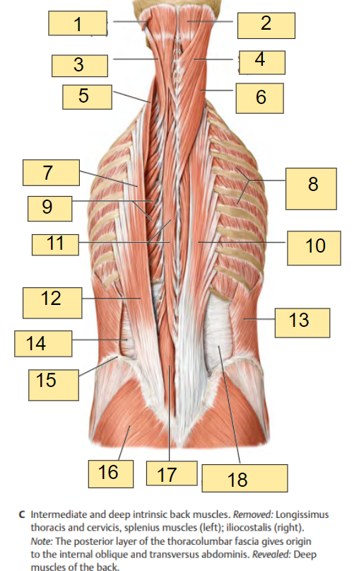 <p><strong><u>Fig. 3.5: Posterior View of Intrinsic Muscles of the Back</u></strong></p><p></p><ul><li><p><strong>Intermediate and Deep Intrinsic Back Muscles</strong></p></li><li><p><strong>Removed</strong>: Longissimus thoracis and cervicis, splenius muscles (left); iliocostalis (right)</p></li><li><p><strong>Revealed</strong>: Deep muscles of the back</p><p></p></li></ul><p>What is labeled in <strong>box #2?</strong></p>