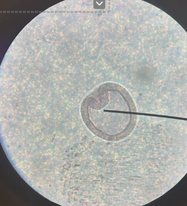 <p>fomation of germ layers</p>