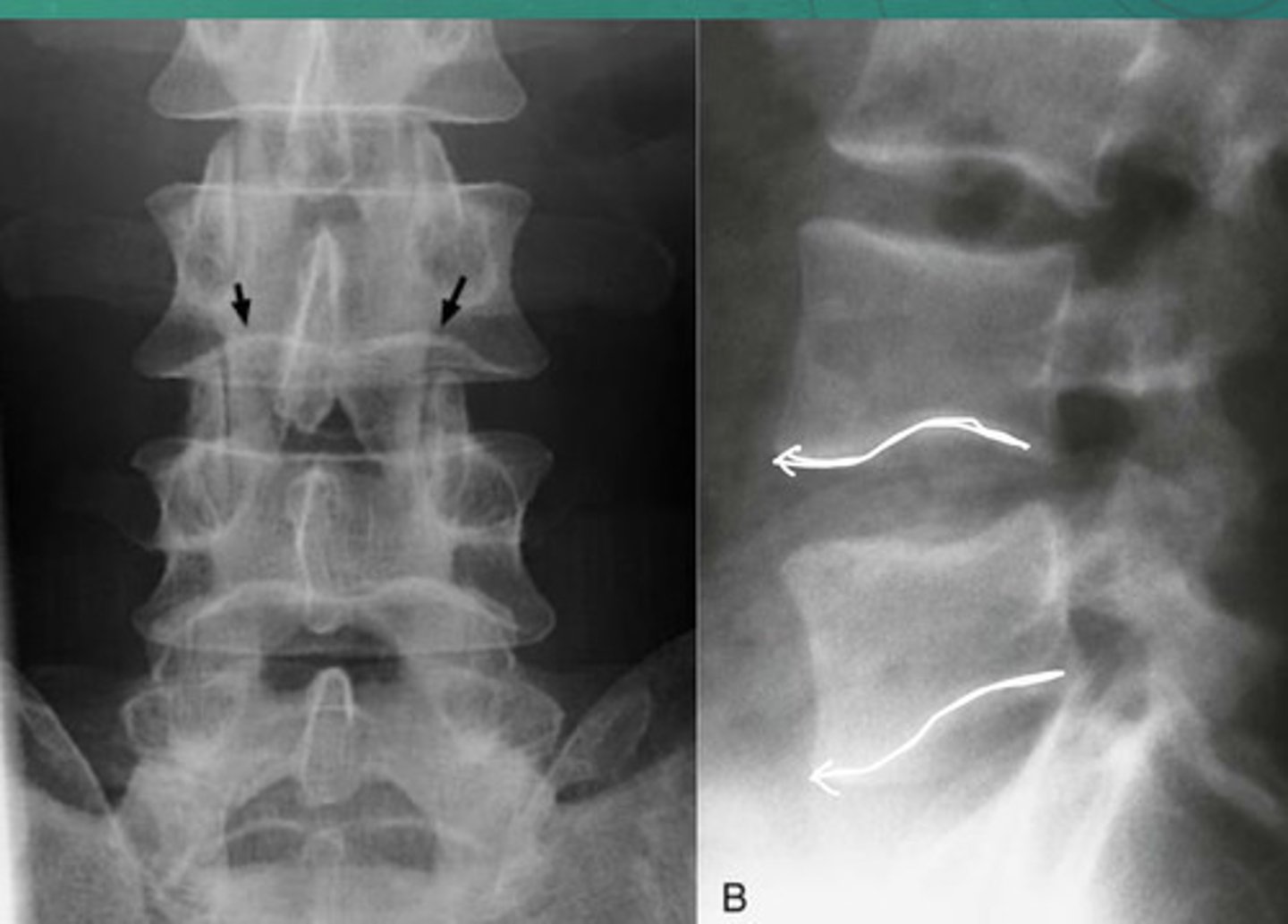<p>What anomaly is this?</p>