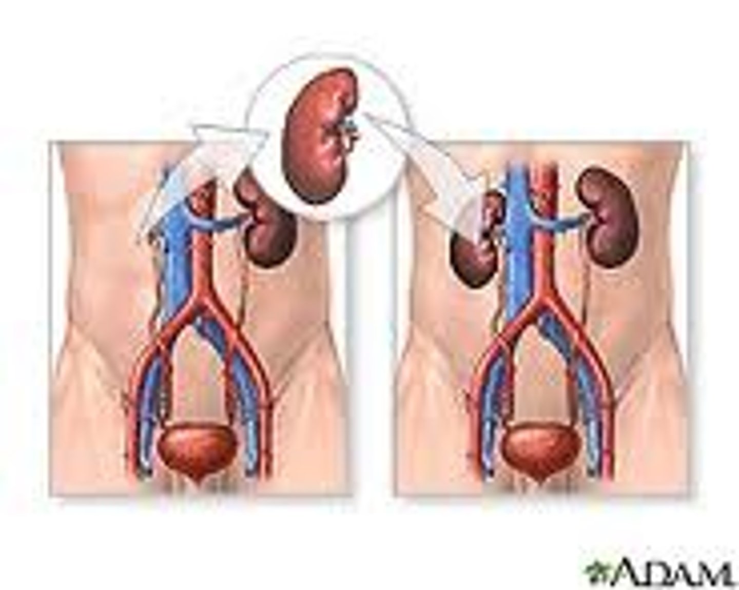 <p>Replacing one person's organ with one from another person who shares the same blood group and similar genetics (ie) relative). Kidneys, Liver, Heart</p>